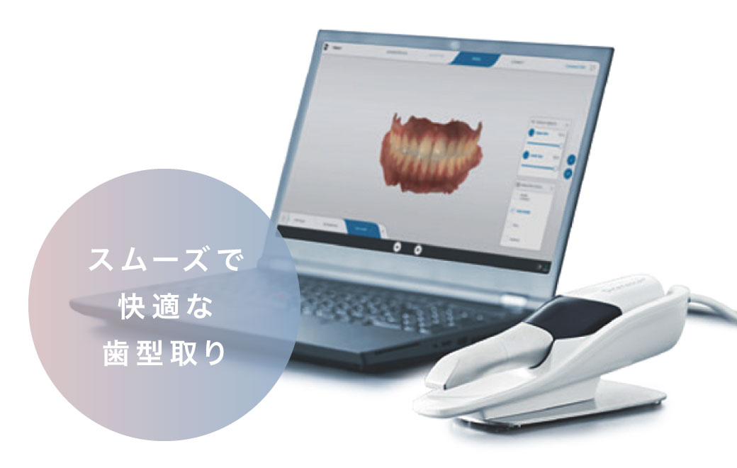 立体撮影/高精細画像/tン時間撮影低被曝